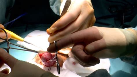 Vidéos Et Rushes De Circumcision Getty Images