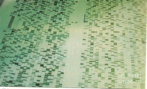 dna sequencing gel photograph  science source fine art america