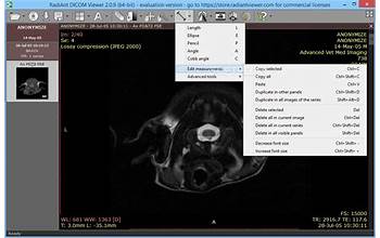 RadiAnt DICOM Viewer screenshot #0