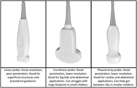 understanding ultrasound probes kidsono