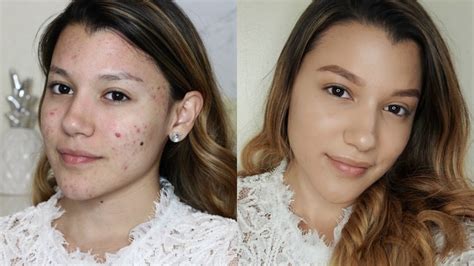 No Makeup Makeup Look For Acne I Msuazo Youtube