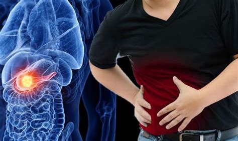 Pancreatic Cancer Symptoms The First ‘noticeable’ Sign In The Stomach