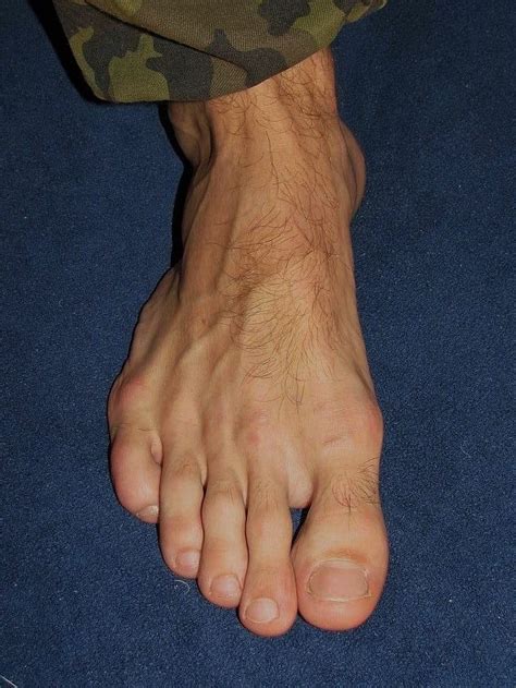 Pin By Fred Flinstone On Bare Feet Male Feet Feet