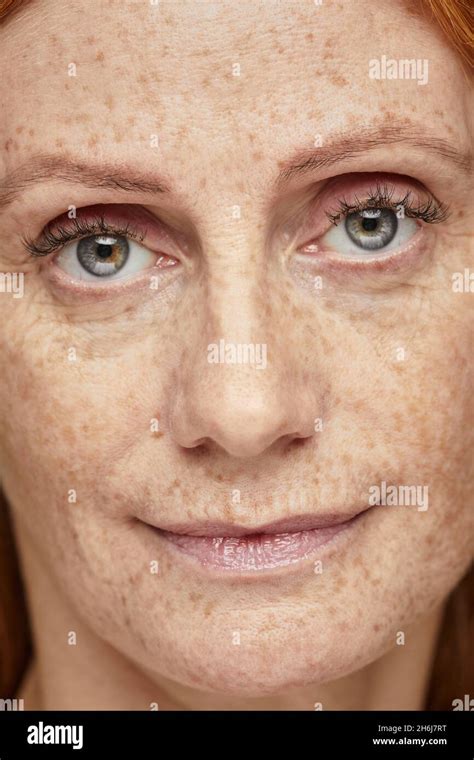 Extreme Close Up Portrait Of Freckled Young Woman With Sparkling Blue