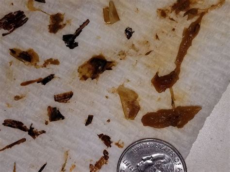 please help me identify this came out after a coffee enema and at parasites support forum