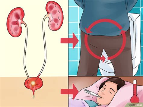 ¿es posible curar una infección urinaria de manera untreated y rápida