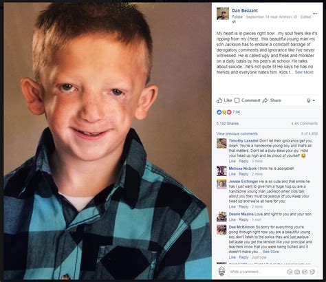 father s facebook post about sick son getting bullied goes viral