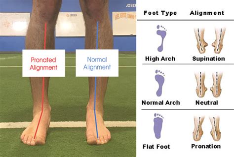 corrective exercise  foot  ankle
