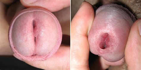 penis inside penis hole excellent porn