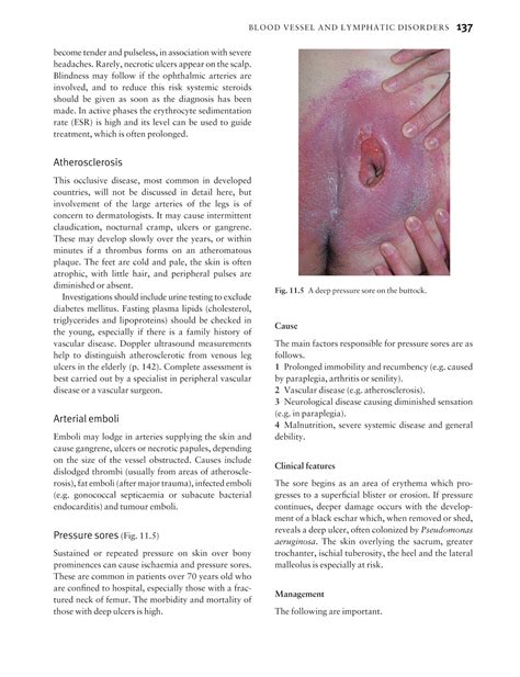 medicine by sfakianakis g alexandros skin disease in perspective 4