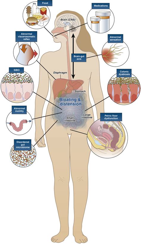 management  chronic abdominal distension  bloating clinical