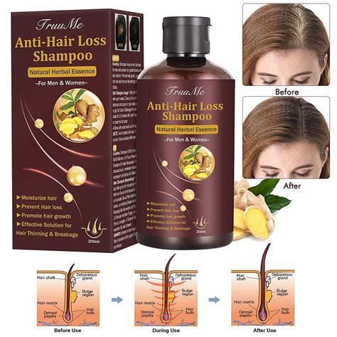 hair growth shampoo hair loss shampoo anti hair loss