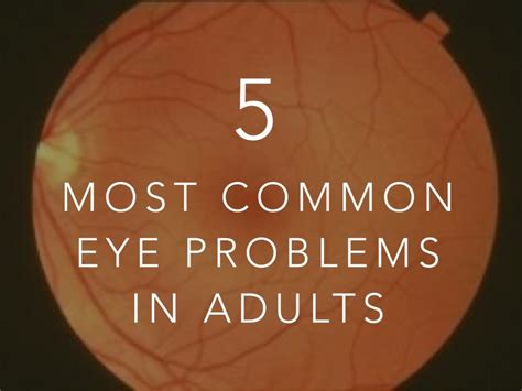 common eye problems  adults hubpages