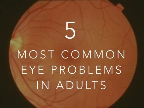 The Five Most Common Eye Problems In Adults