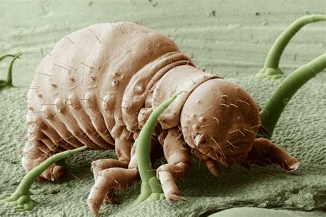 11 magnified photos of creepy crawlies microscopic