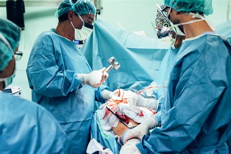 team  surgeons operating general blog