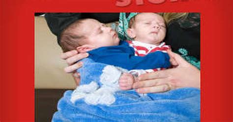 Conjoined Twins Go Home Daily Star