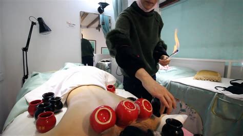 chinese fire cupping therapy youtube