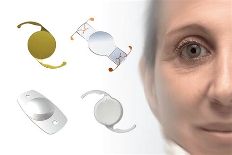 lentes intraoculares para catarata cirurgia refrativa catarata e
