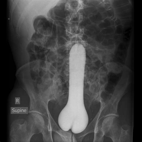 dildo plug rectum x ray 16 like ra s naughty blog