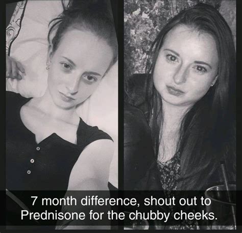 black  white       woman showing   month difference   face due
