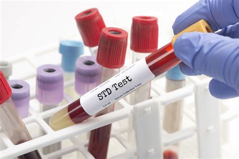 why use an in home std test kit