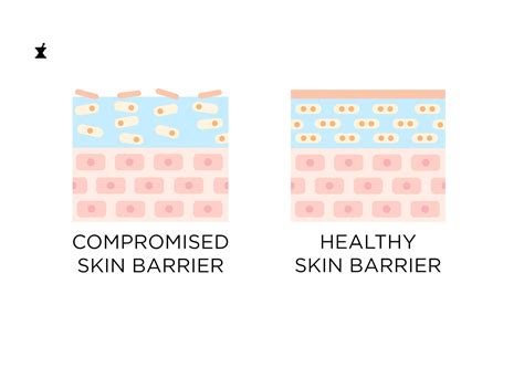 skin barrier  damaged  ways  repair