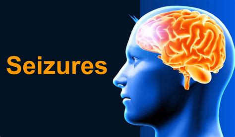 seizures types  symptoms diagnosis treatment