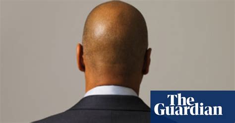 dr luisa dillner s guide to…baldness health and wellbeing the guardian