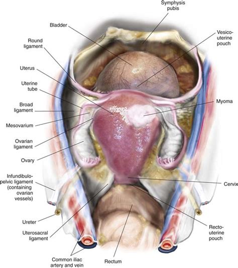 Abdominal Hysterectomy Obgyn Key