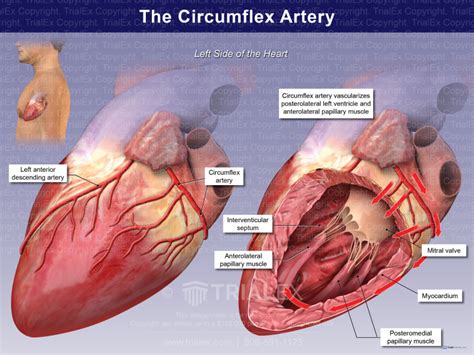 circumflex artery trial exhibits