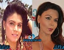 Image result for Rakhi Sawant Before and After Surgery. Size: 127 x 100. Source: plasticsurgeryfact.com