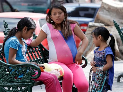 Cada Día Se Registran En México Mil Embarazos En Adolescentes Cerca De