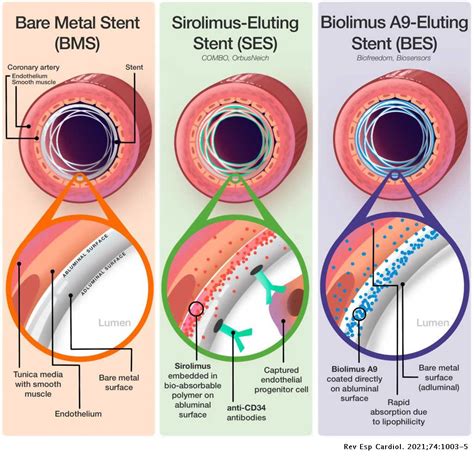drug eluting stents  improve coronary endothelial  microvascular function  stemi