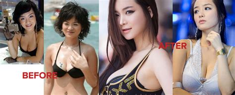 10 shocking photos of korean celebrity plastic surgery page 4 amped asia magazine