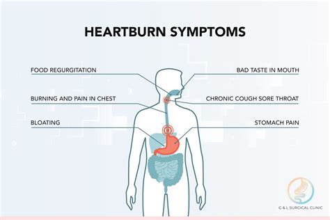 suffering  heartburn  acid reflux