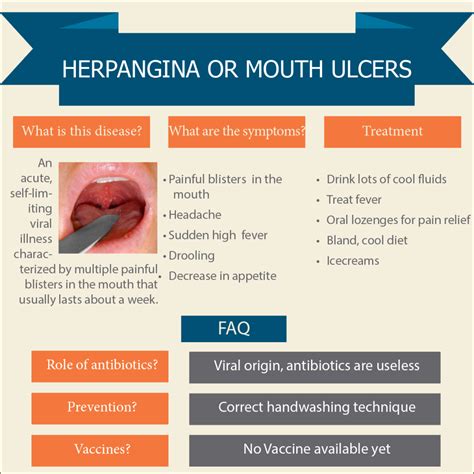 herpangina  painful mouth ulcers nathani clinic