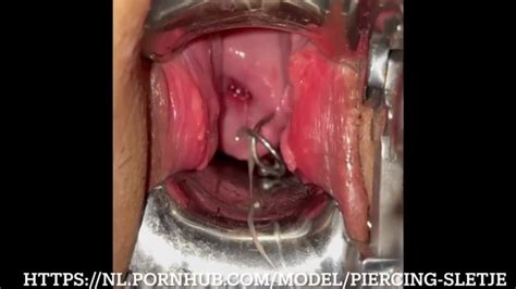 Sounding Her Uterus With Nice View On Her Second Uterus Piercing