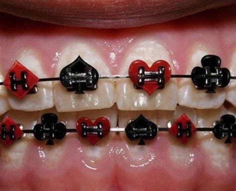 dentistas dientes odontologos ortodoncia brackets