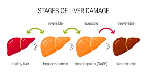 liver disease and diet a guide for adult patients their carers and