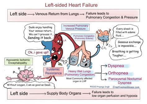heart failure left sided   sided creative med doses
