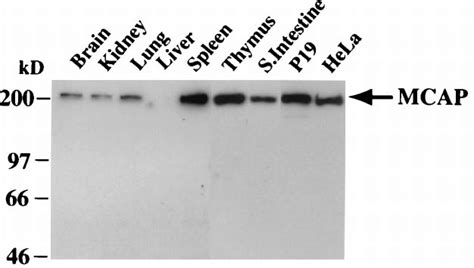 mcap protein expression detected  immunoblot analysis  anti mcap  scientific
