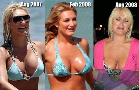 brooke hogan plastic surgery breast implants nose job