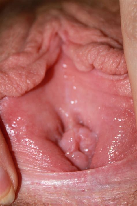 vaginal opening swelling right after sex nude gallery