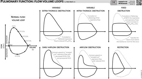 pulmonary function testing flow volume loop patterns grepmed