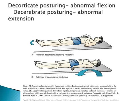 altered cerebral function increased intracranial pressure