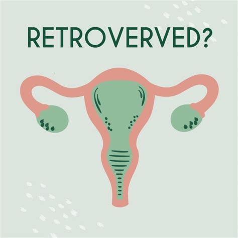 Retroverted Uterus Find Out How To Position Femi Eko