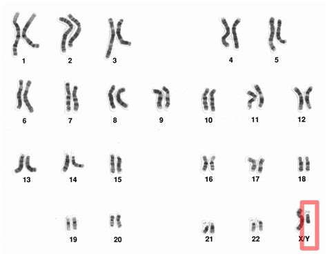 The Y Chromosome Is Disappearing What Does It Mean For Men World
