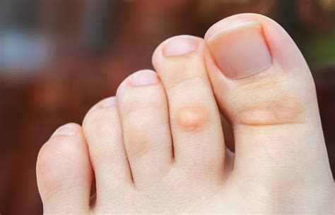 what can your feet tell you about your health