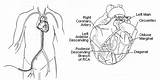 Catheterization Cardiac Coronary Heart Procedure Test Before Risks sketch template